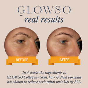 GLOWSO Collagen + Skin, Hair & Nails Formula